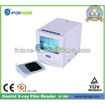 HOT PRODUCT--Dental X-ray Film Reader (Model:E-188)